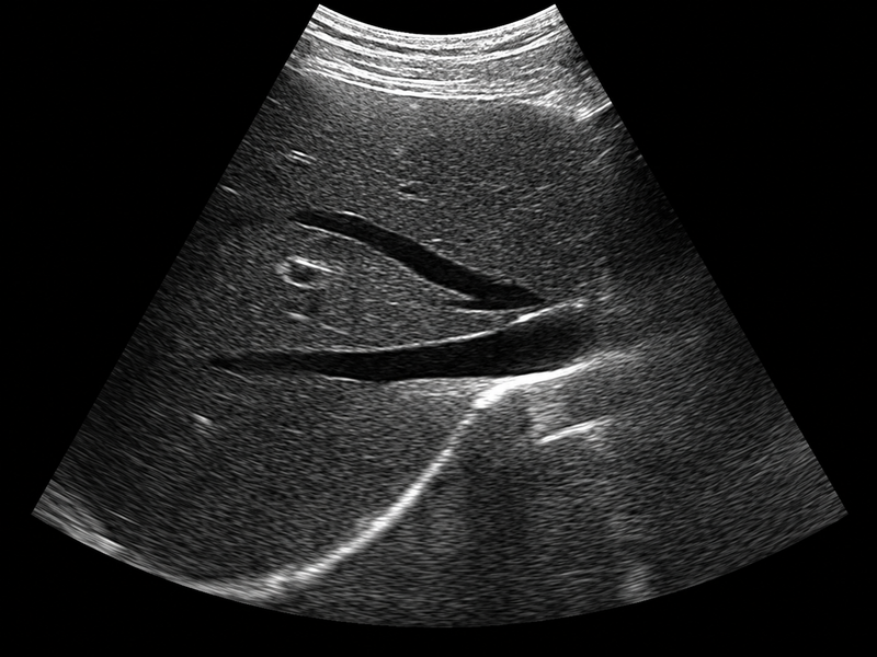 Representative abdominal ultrasound image