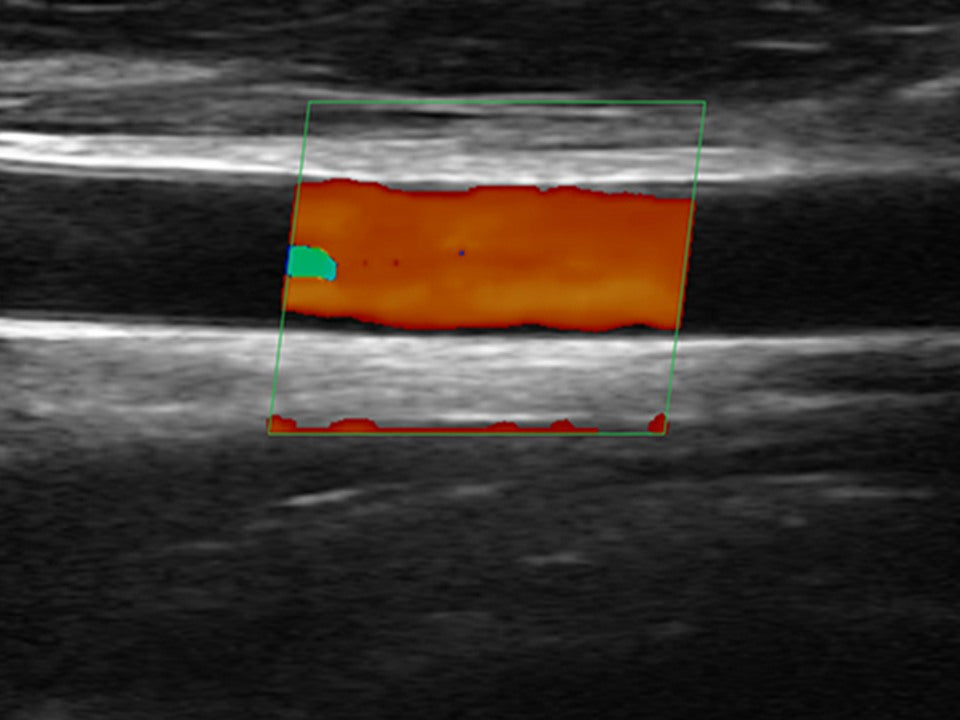 Source-provided linear color acoustic-field crop for the Triad platform
